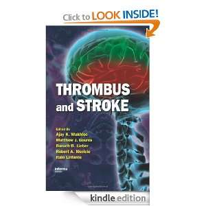 Thrombus and Stroke (Neurological Disease and Therapy) Ajay K 