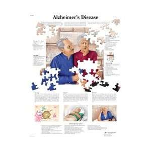 Alzheimers Disease   Anatomical Chart  Industrial 