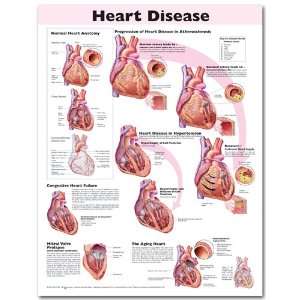 Heart Disease Anatomical Chart Unmounted 9912PU  
