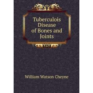   Tuberculois Disease of Bones and Joints William Watson Cheyne Books