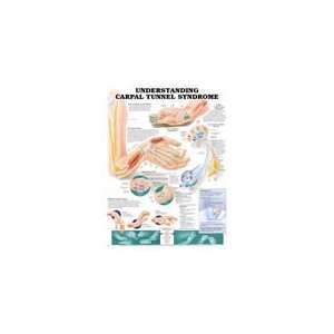   Understanding Carpal Tunnel Syndrome Anatomical Chart by Simulaids